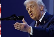 Trump Reveals Reason Behind Huge Bruise On His Hand